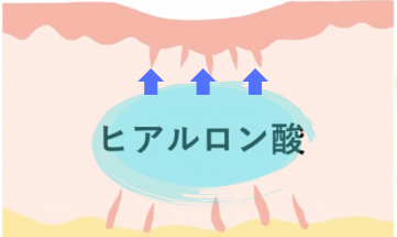 ヒアルロン酸注入